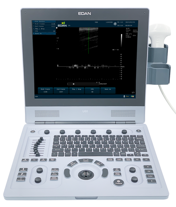 EDANUSA U60 ULTRASOUND