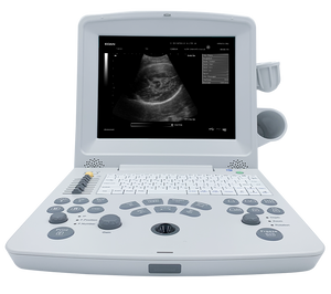 EDANUSA DUS60 ULTRASOUND