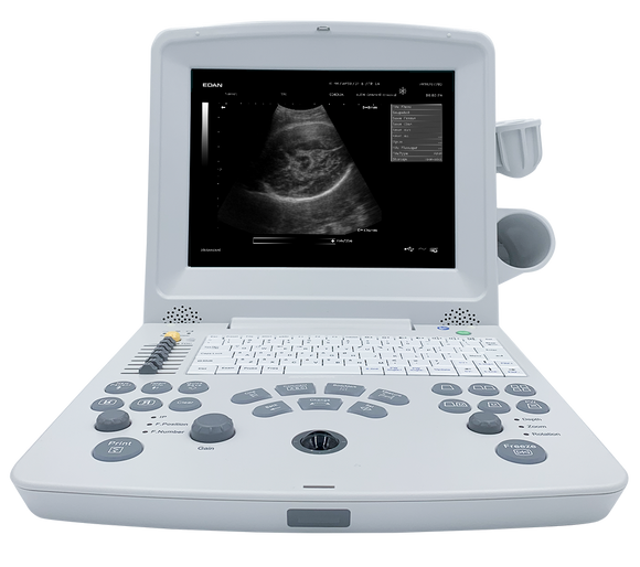 EDANUSA DUS60 ULTRASOUND